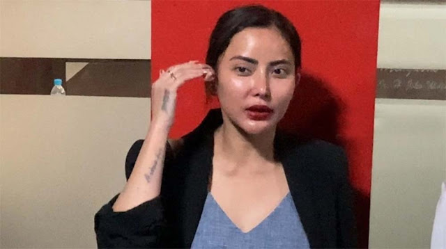 Ayu Aulia Sebut Polisi Sudah Kantongi Tersangka dari Laporan Ridwan Kamil