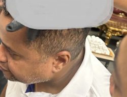 Kondisi Terkini Pelatih Persik Kediri Divaldo Alves yang Jadi Korban Insiden Pelemparan Bus