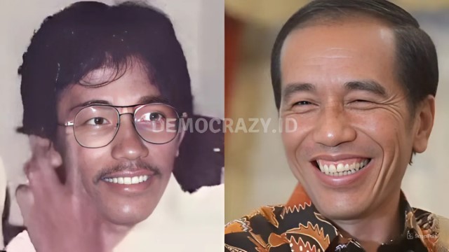 Mari Lihat & Simpulkan Sendiri! Analisa Gigi Jokowi Dulu dan Sekarang Dengan Metode Odontologi Forensik
