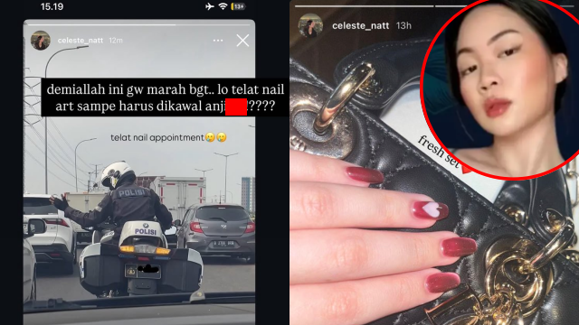 Sosok Celeste Anastasya, Diduga Aspri Hotman Paris, Viral Dikawal Patwal Gegara Telat Nail Art