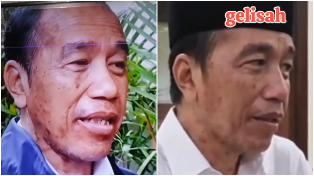 Wajah Jokowi Disorot Netizen, Terlihat Kusam dan Penuh Flek, Tanda Stres atau Efek Obat-obatan?