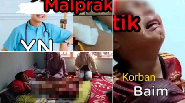 Alat Kelamin Bocah 10 Tahun di Kerinci Terpotong Saat Disunat Laser, Diduga Malapraktik