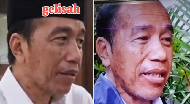 Wajah Jokowi Terlihat Kusam dan Penuh Flek, Tanda Stres Berat atau Perawatan?