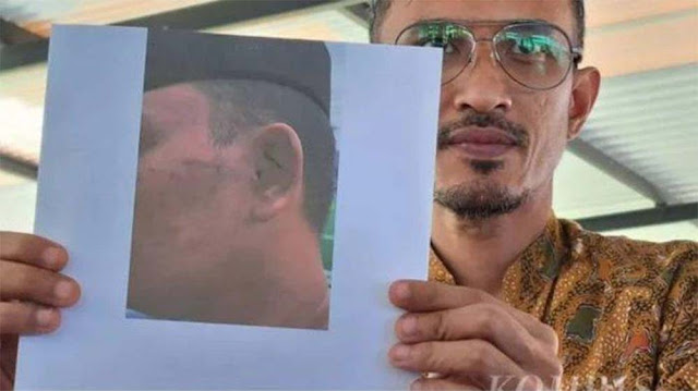 Korban Penganiayaan di Ponpes Milik Gus Miftah Dilaporkan Balik karena Dituding Curi Uang Rp 700 Ribu