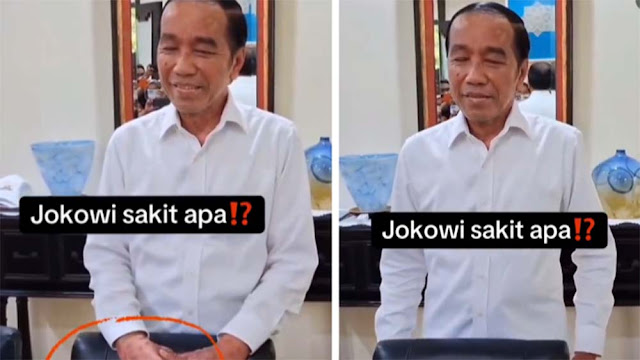 Publik Soroti Gestur Jokowi Sembunyikan Tangan Saat Wawancara, Sakit Kulit Makin Parah?