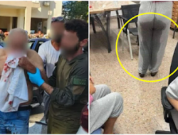 Unggah Foto-Foto Korban Rudal Iran, Israel Tak Dapat Simpati Malah Dibilang Kena Karma atas Gaza