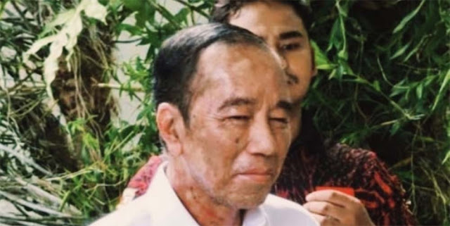 Diduga Sakit Kulit Serius, Amien Rais Serukan Jokowi Bertobat