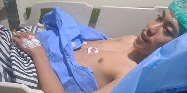 Kader PMII Unija Korban Demo Ternyata Bukan Kena Peluru Karet