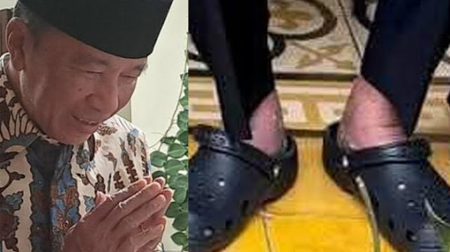 Dokter Tifa Prihatin dengan Kondisi Jokowi, Minta Segera Taubat Nasuha
