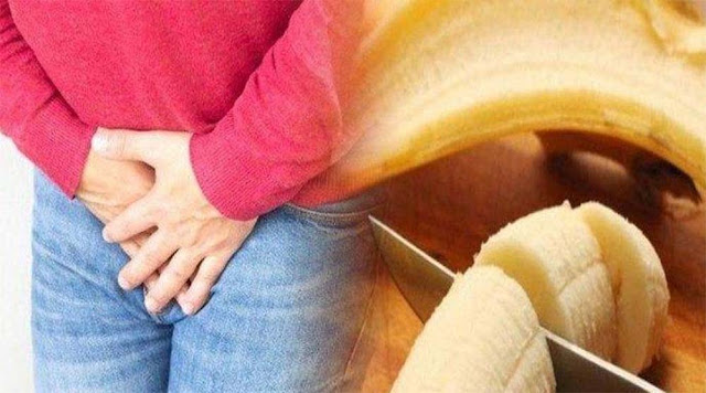Wanita Potong Kelamin Pacar Usai Tahu Korban Sudah Beristri