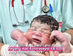Menggemparkan! Bayi Lahir dengan Genggaman Alat KB IUD Ibunya, Kok Bisa?