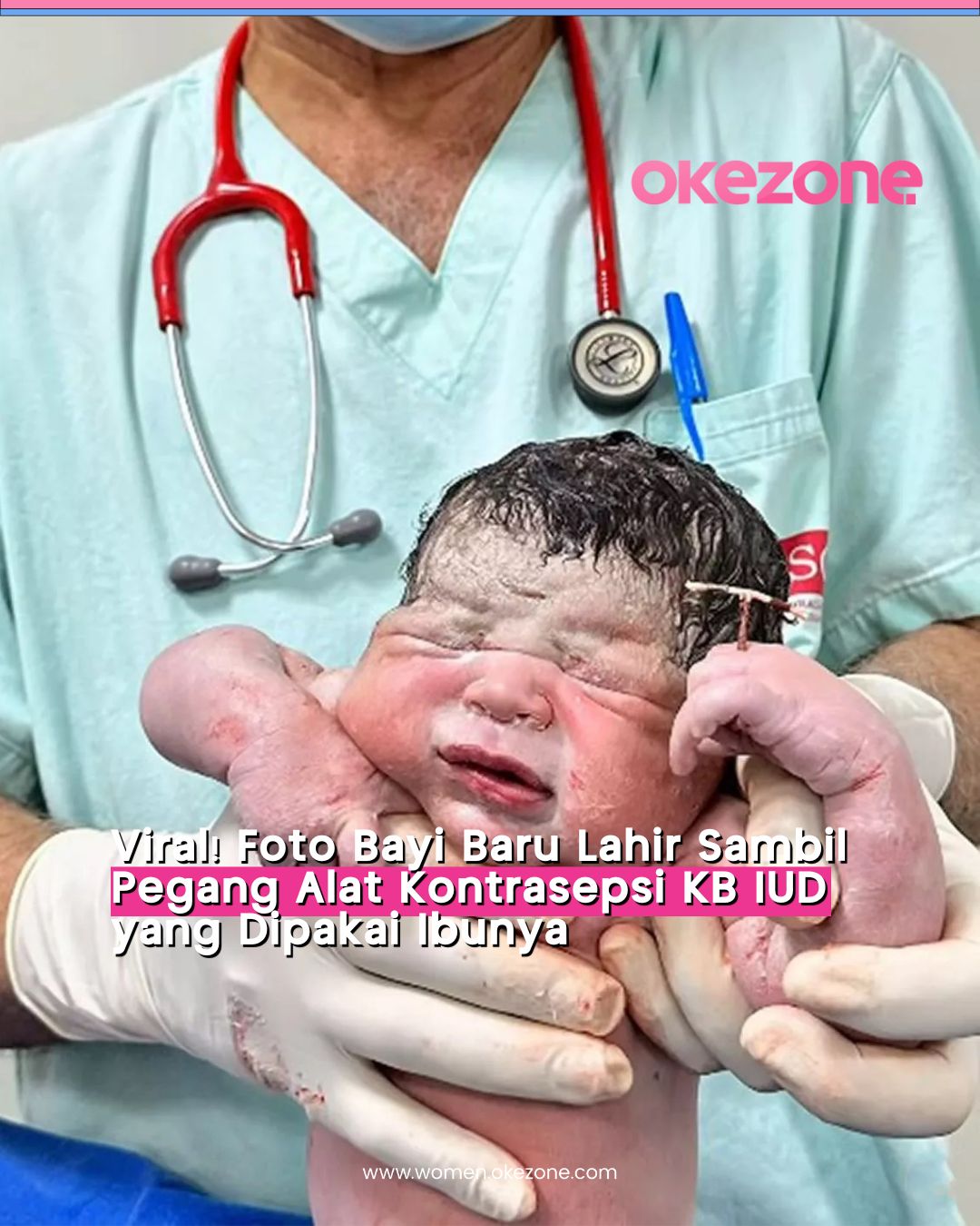Menggemparkan! Bayi Lahir dengan Genggaman Alat KB IUD Ibunya, Kok Bisa?