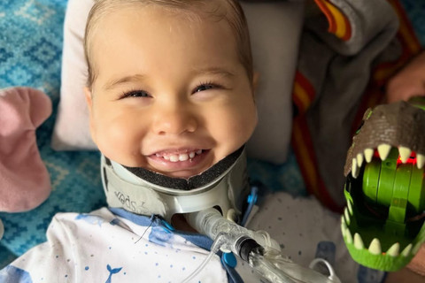 Kepala Terlepas dari Tulang Belakang, Ini Kisah Ajaib Oliver yang Kini Bisa Tertawa Lagi