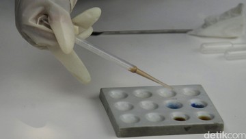 Onadio Leonardo & Temannya KR Positif Narkoba, Hasil Tes Urine Polisi Membuktikan