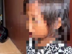 Bocah SDN 150 Gandus Palembang Pulang dengan Mata Lebam, Diduga Dipikul Guru Pakai Cincin