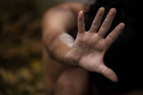 Dugaan Kekerasan Siswi SDN 150 Gandus Palembang: Fakta & Respons Dinas Pendidikan