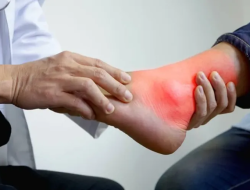 7 Buah Penurun Asam Urat yang Efektif dan Terbukti Alami
