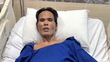 Fahmi Bo Akhirnya Operasi Batu Empedu: Jadwal Terbaru & Peran Raffi Ahmad