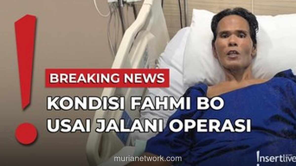 Fahmi Bo Pulang dari RS Usai Operasi Batu Empedu, Ungkap Kondisi Terkini