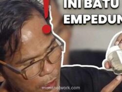Fahmi Bo Pulang dari RS: Ungkap Kondisi Terkini & Bukti Operasi Batu Empedu