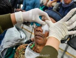 Operasi Katarak Gratis 2025 di Jakarta: Syarat, Jadwal & Cara Daftar