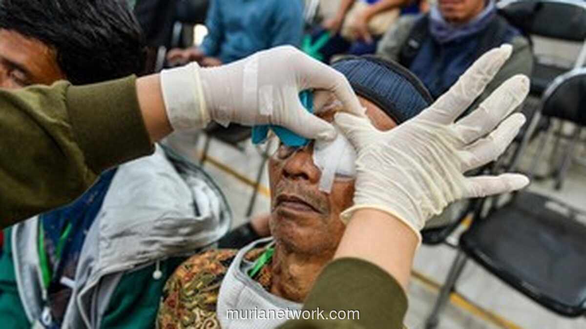 Operasi Katarak Gratis 2025 di Jakarta: Syarat, Jadwal & Cara Daftar