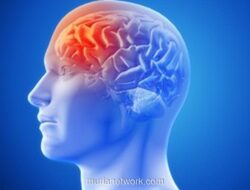 Pijat Kretek Picu Lima Kali Stroke Beruntun, Wanita Ini Harus Belajar Jalan Lagi