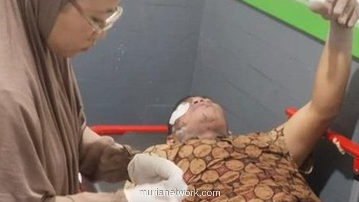 Pasutri Nekat Lawan Awan Panas Semeru, Berujung Luka Bakar