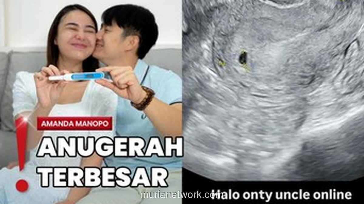 Amanda Manopo Pamer Dua Garis, Ungkap Kabar Kehamilan dengan Gaya Blak-blakannya