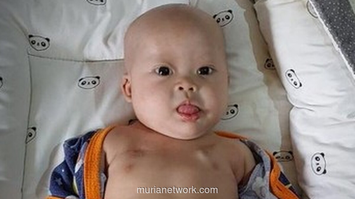 Delapan Bulan Berjuang Melawan Tumor Ganas, Chiara Butuh Uluran Tangan