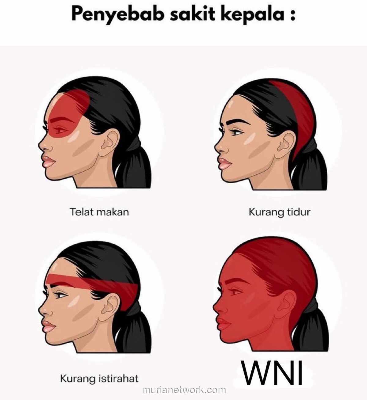 Dari Dahi Sampai Belakang Kepala, Ini Arti Letak Sakit Kepala Anda