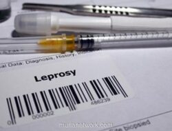 Kusta Muncul Kembali di Rumania Setelah 44 Tahun, Dua WNI Teridentifikasi