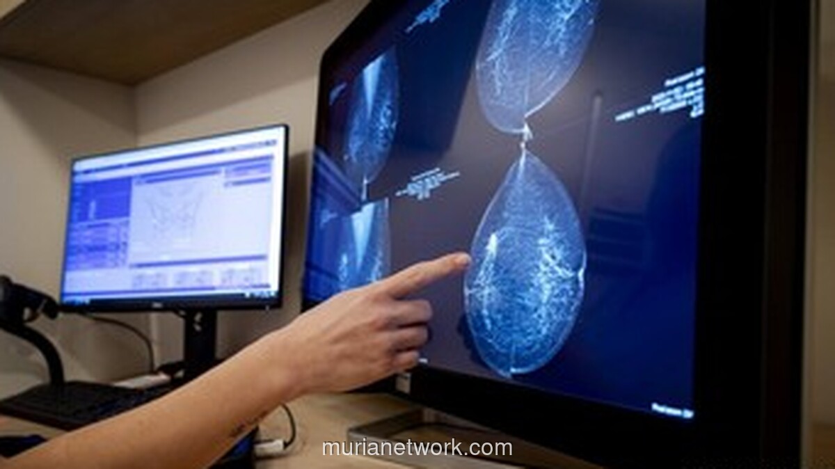 AI Baca Mammogram, Deteksi Kanker Payudara Meski Hasilnya Bersih