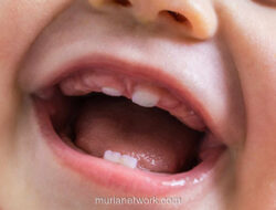 Empat Gigi Sekaligus Muncul, Si Kecil Mogok Makan? Ini Kata Dokter