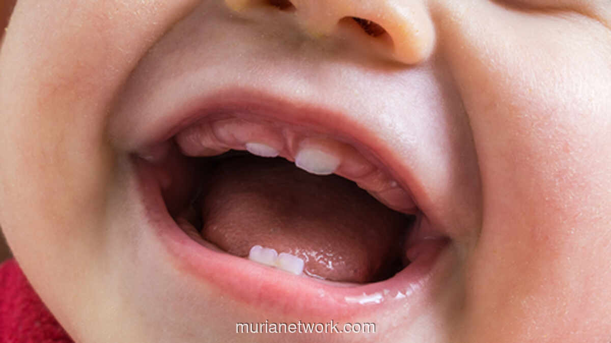 Empat Gigi Sekaligus Muncul, Si Kecil Mogok Makan? Ini Kata Dokter