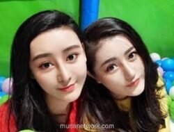 37 Kali Oplas Demi Mirip Fan Bingbing, Kini Ia Hidup Sendiri dan Berdamai dengan Diri