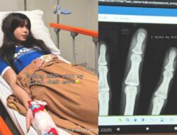 Sabrina Chairunnisa Patahkan Jari Tengah Usai Tertimpa Lelucon Sendiri