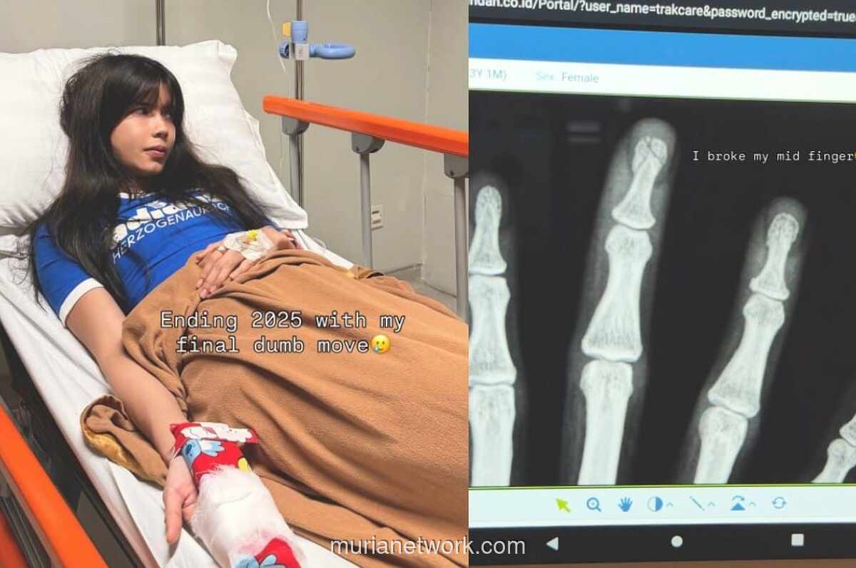 Sabrina Chairunnisa Patahkan Jari Tengah Usai Tertimpa Lelucon Sendiri