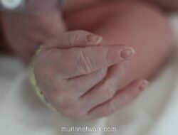 Video Bayi dengan Bercak Cokelat Viral, Dokter: Ini Café-au-lait Spots, Tak Perlu Panik