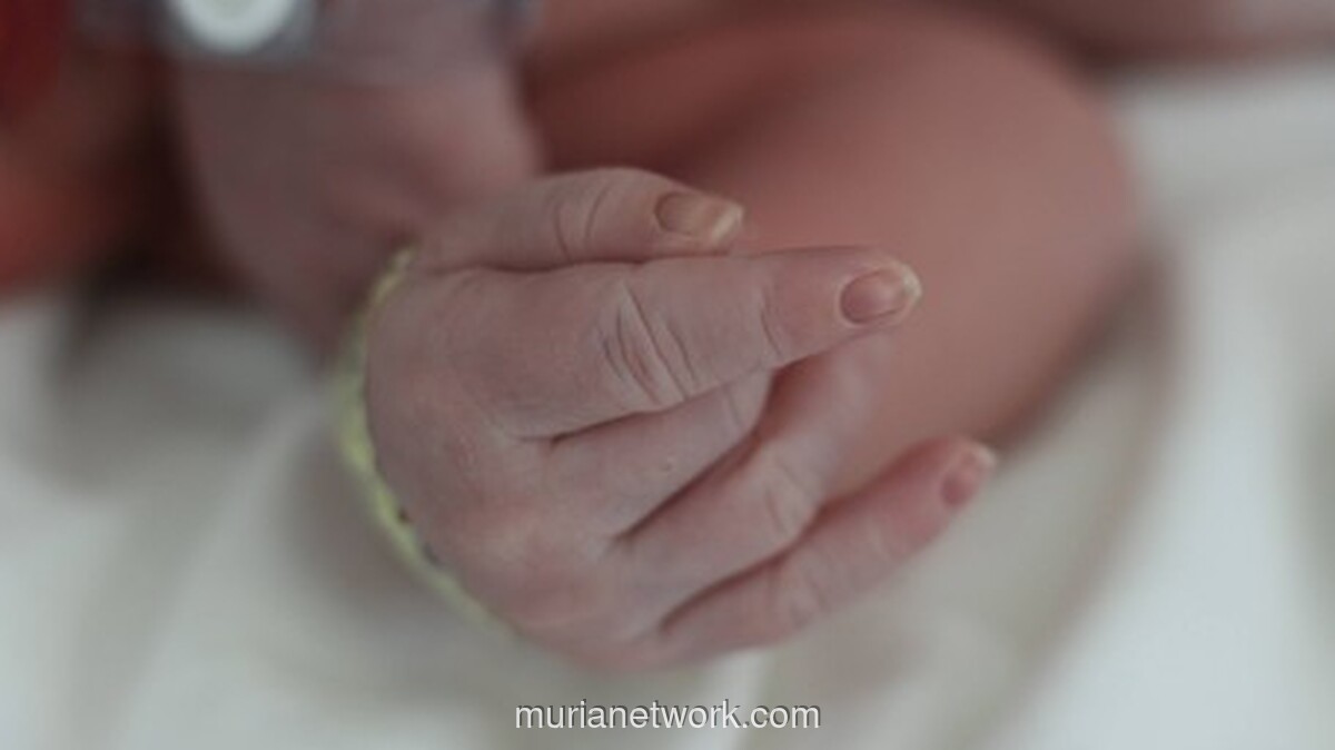 Video Bayi dengan Bercak Cokelat Viral, Dokter: Ini Café-au-lait Spots, Tak Perlu Panik