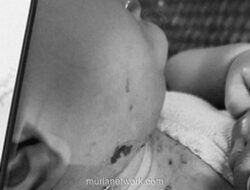 Bayi di Atu Payung Ternyata Sehat, Tim Medis Tempuh 14 Jam Lewat Medan Terjal