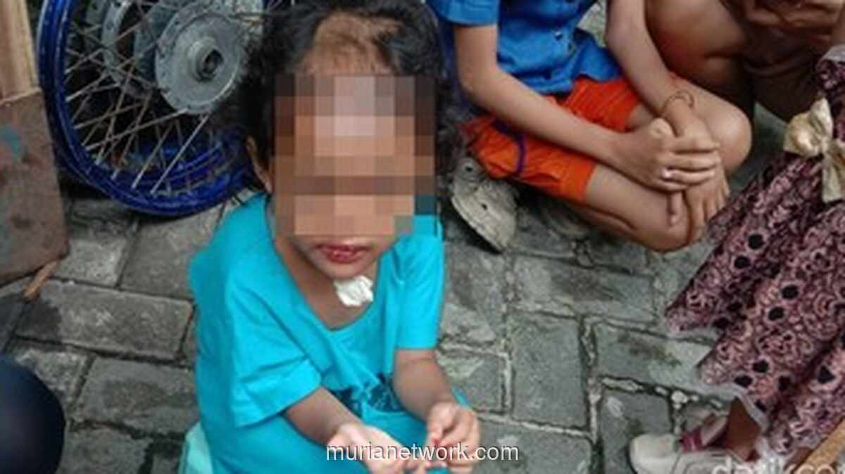 Balita 4 Tahun di Surabaya Jadi Korban Penganiayaan Paman dan Bibi Selama Dua Bulan