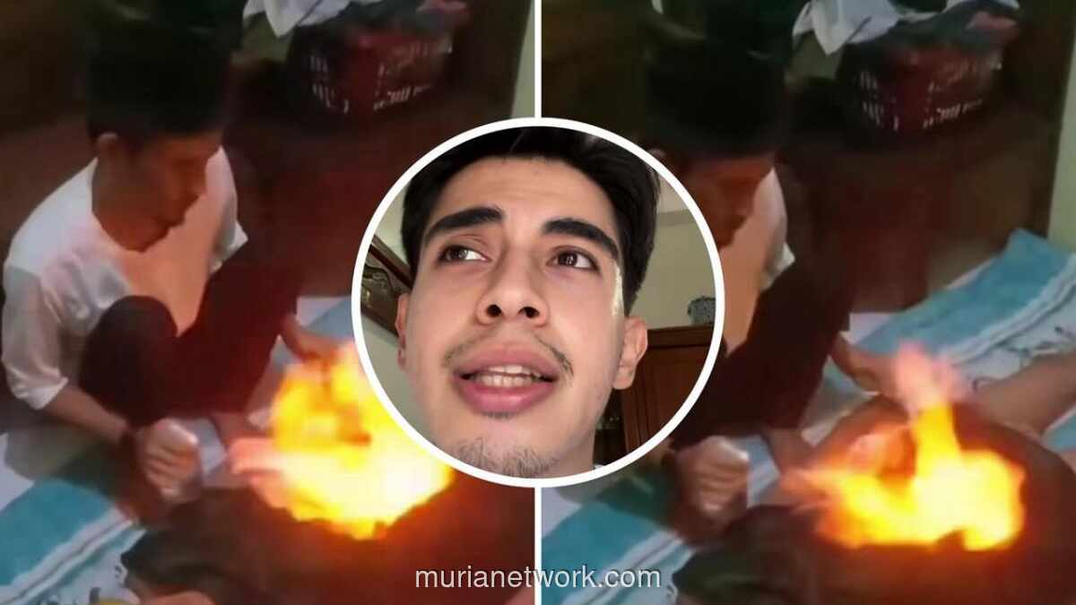 Dokter Peringatkan Bahaya Terapi Api untuk Obati GERD dan Sesak Napas