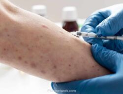 Kemenkes Tingkatkan Kewaspadaan Campak Jelang Mudik Lebaran