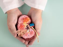 CAPD, Terapi Gagal Ginjal yang Lebih Fleksibel, Masih Minim Dikenal Pasien