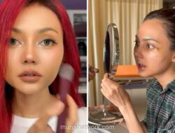 Rina Nose Buka Alasan di Balik Operasi Hidung Setelah 10 Tahun Pertimbangan