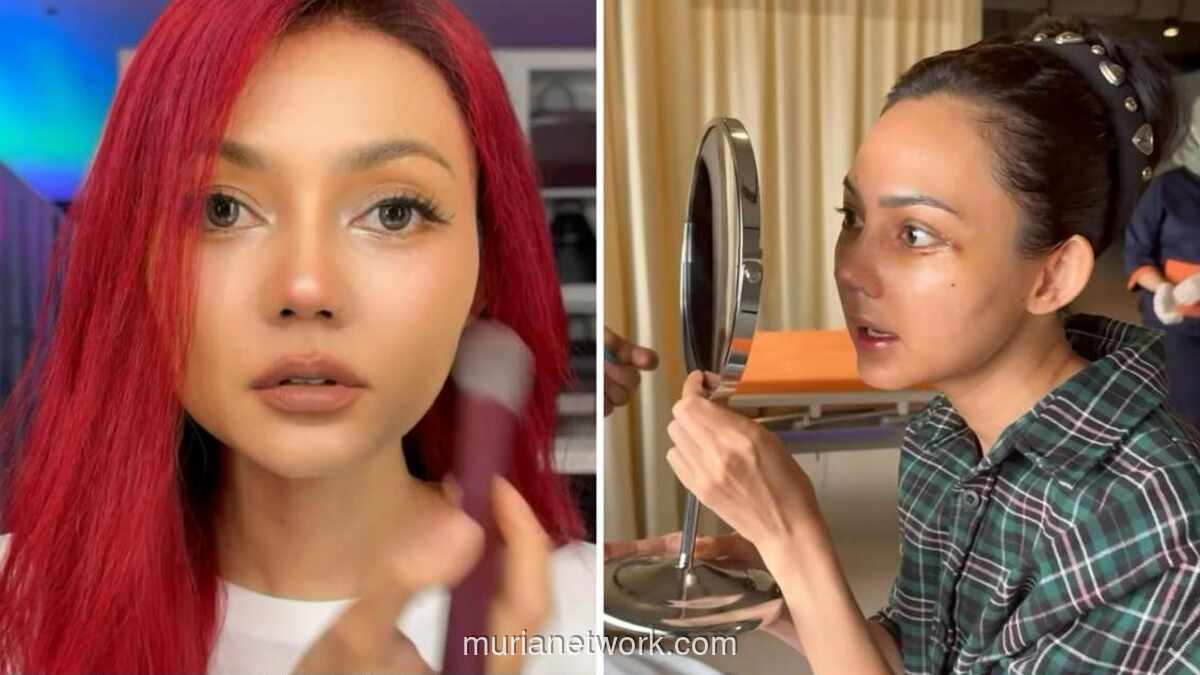 Rina Nose Buka Alasan di Balik Operasi Hidung Setelah 10 Tahun Pertimbangan