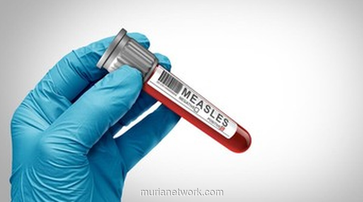 Dinkes Banten Waspadai Lonjakan Kasus Campak Usai 6 Pasien Meninggal