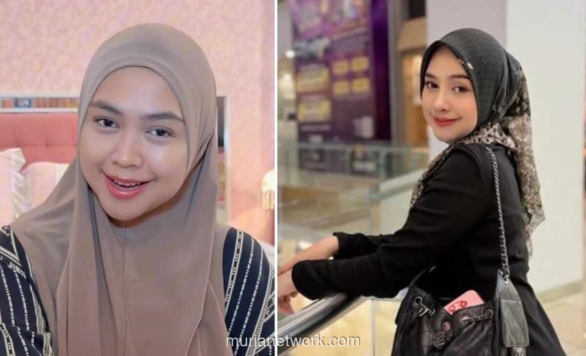 Ria Ricis Akui Operasi Hidung demi Kesehatan, Bukan Sekadar Estetik