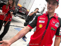 Bekas Luka Cedera Kecelakaan Austin Masih Nyata, Marc Marquez Nekat Balapan di MotoGP Spanyol